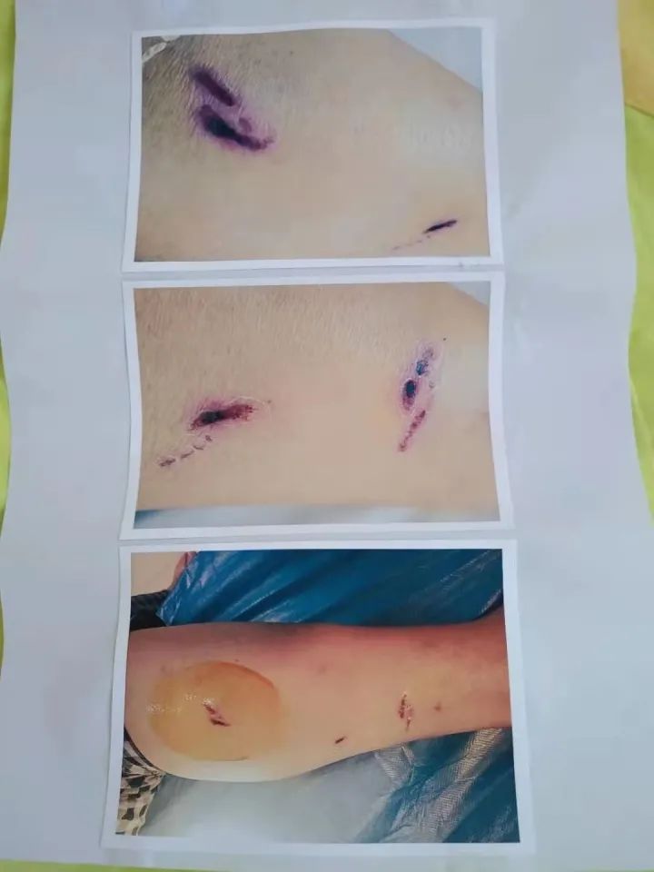 给狗接种狂犬疫苗_狂犬疫苗狗_狗狂犬疫苗多少钱